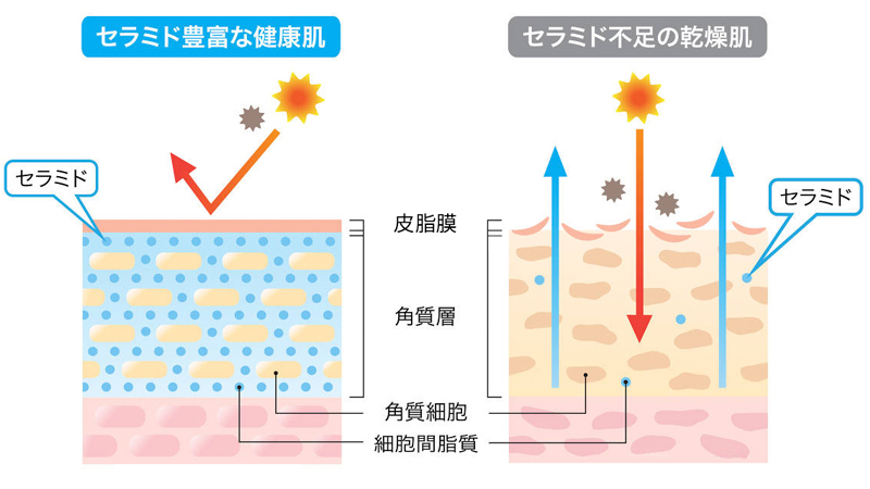 セラミド豊富な健康肌とセラミド不足の乾燥肌